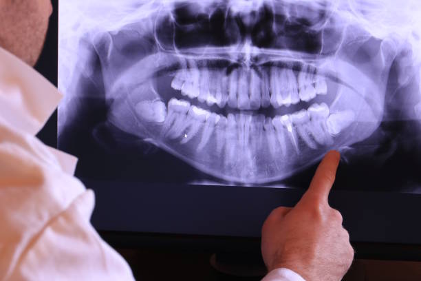 Best Emergency Root Canal Treatment in Covington, TN